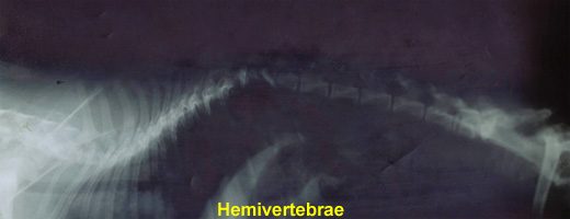 Hemivertebrae